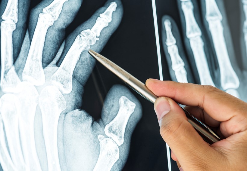 Kako smo optimizirali delo hrvaškega proizvajalca OSTEOGROW zdravila za regeneracijo kosti in skrajšali postopke prilagajanja temperaturnih podatkov? - Sartorius Croatia